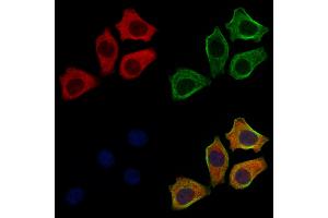 ABIN6261855 and ABIN6272633 staining HepG2 cells by IF/ICC. (GABARAPL2 antibody  (N-Term))