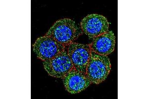 Confocal immunofluorescent analysis of PTK2 Antibody (C-term) (ABIN652554 and ABIN2842372) with 293 cell followed by Alexa Fluor 488-conjugated goat anti-rabbit lgG (green). (FAK antibody  (C-Term))