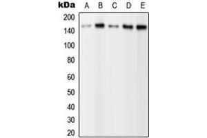 Western blot analysis of PLC gamma 2 (pY1217) expression in HEK293T EGF-treated (A), A431 (B), NIH3T3 (C), SP2/0 EGF-treated (D), H9C2 EGF-treated (E) whole cell lysates.