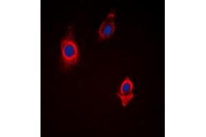 Immunofluorescent analysis of Vinculin staining in HepG2 cells. (Vinculin antibody  (Center))