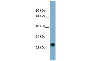 WB Suggested Anti-RAB22A Antibody Titration: 0. (RAB22A antibody  (Middle Region))