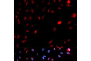 Immunofluorescence analysis of MCF-7 cells using Phospho-CDK1(Y15) Polyclonal Antibody