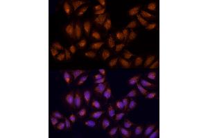 Immunofluorescence analysis of U2OS using AGPS antibody (ABIN6129641, ABIN6136644, ABIN6136645 and ABIN6214756) at dilution of 1:100 (40x lens). (AGPS antibody  (AA 379-658))