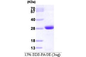 SDS-PAGE (SDS) image for Growth Factor Receptor-Bound Protein 2 (GRB2) (AA 1-217) protein (His tag) (ABIN667098) (GRB2 Protein (AA 1-217) (His tag))