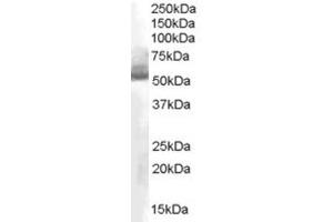Western Blotting (WB) image for anti-Aldehyde Dehydrogenase 1 Family, Member A1 (ALDH1A1) (C-Term) antibody (ABIN2465388) (ALDH1A1 antibody  (C-Term))