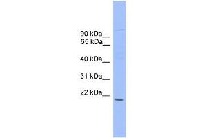 WB Suggested Anti-ZNF655 Antibody Titration:  0.