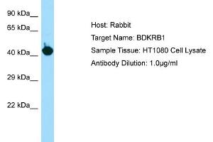Host: RabbitTarget Name: BDKRB1Antibody Dilution: 1. (BDKRB1 antibody  (C-Term))