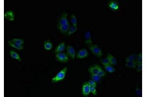Immunofluorescent analysis of HepG2 cells using ABIN7170183 at dilution of 1:100 and Alexa Fluor 488-congugated AffiniPure Goat Anti-Rabbit IgG(H+L) (SLC25A33 antibody  (AA 66-120))