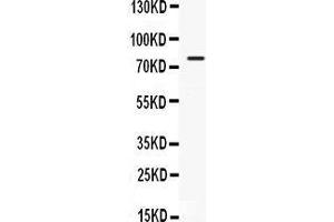 Observed bind size: 80KD (GRP78 antibody  (C-Term))