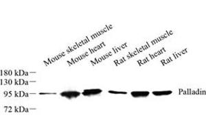 Western blot analysis of palladin (ABIN7074976) at dilution of 1: 1000 (PALLD antibody)