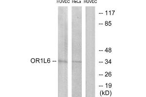 Western Blotting (WB) image for anti-Olfactory Receptor, Family 1, Subfamily L, Member 6 (OR1L6) (Internal Region) antibody (ABIN1853198) (OR1L6 antibody  (Internal Region))