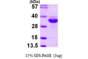 SDS-PAGE (SDS) image for Enolase-Phosphatase 1 (ENOPH1) (AA 1-261) protein (His tag) (ABIN667878) (MASA Protein (AA 1-261) (His tag))