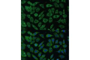 Immunofluorescence analysis of L929 cells using  Polyclonal Antibody (ABIN7265493) at dilution of 1:100 (40x lens). (ARL3 antibody  (AA 1-182))