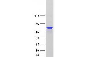 Western Blotting (WB) image for Microtubule-associated Tumor Suppressor Candidate 2 (MTUS2) (Transcript Variant 2) protein (Myc-DYKDDDDK Tag) (ABIN2724202)