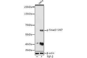Western blot analysis of extracts of HeLa cells, using Phospho-Smad2-S467 antibody (ABIN3019982, ABIN3019983, ABIN3019984 and ABIN1682048) at 1:1000 dilution. (SMAD2 antibody  (pSer467))