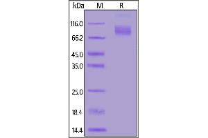 SDS-PAGE (SDS) image for Tumor Necrosis Factor Receptor Superfamily, Member 8 (TNFRSF8) (AA 19-379) (Active) protein (Fc Tag,FITC) (ABIN6972983)