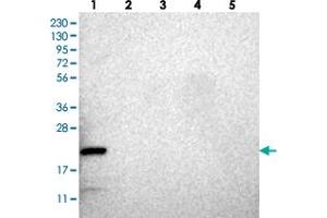 Western blot analysis of Lane 1: RT-4, Lane 2: U-251 MG, Lane 3: Human Plasma, Lane 4: Liver, Lane 5: Tonsil with CCDC25 polyclonal antibody  at 1:250-1:500 dilution. (CCDC25 antibody)