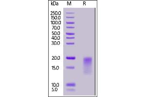 Human BAFFR Protein, His Tag on  under reducing (R) condition. (TNFRSF13C Protein (AA 7-71) (His tag))