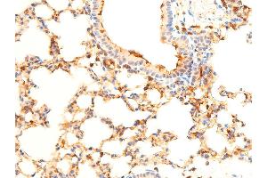 ABIN6267071 at 1/100 staining mouse lung tissue sections by IHC-P. (SYK antibody  (pTyr323))