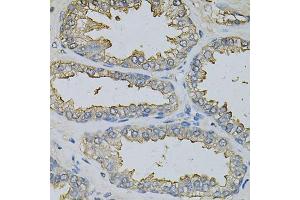 Immunohistochemistry of paraffin-embedded human prostate using DBI Antibody. (Diazepam Binding Inhibitor antibody)