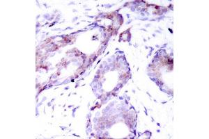 Immunohistochemistry (IHC) image for anti-Myc Proto-Oncogene protein (MYC) (pSer373) antibody (ABIN1870452) (c-MYC antibody  (pSer373))