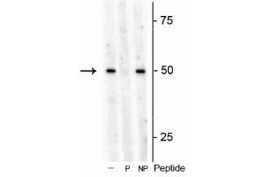 Western blot of Arabidopsis lysate showing specific immunolabeling of the ~53 kDa S6K1 phosphorylated at Thr449 in the first lane (-). (RPS6KB1 antibody  (pThr449))