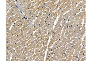 anti-Killer Cell Immunoglobulin-Like Receptor, three Domains, Long Cytoplasmic Tail, 2 (KIR3DL2) antibody
