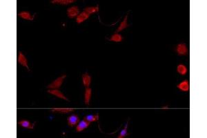 Immunofluorescence analysis of NIH/3T3 cells using CD40L Polyclonal Antibody at dilution of 1:100. (CD40 Ligand antibody)