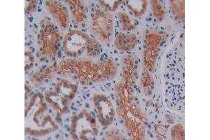 Used in DAB staining on fromalin fixed paraffin- embedded kidney tissue (Reelin antibody  (AA 2086-2296))