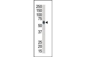 Image no. 1 for anti-Kinase Suppressor of Ras 1 (KSR1) (N-Term) antibody (ABIN360141) (KSR1 antibody  (N-Term))