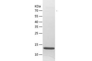 Western Blotting (WB) image for Interleukin 22 (IL22) (AA 27-172) protein (His tag) (ABIN7123576) (IL-22 Protein (AA 27-172) (His tag))