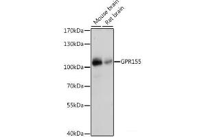 Western blot analysis of extracts of various cell lines using GPR155 Polyclonal Antibody at dilution of 1:1000. (GPR155 antibody)