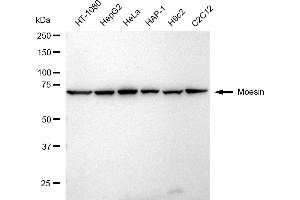 Western blotting analysis using Moesin antibody (ABIN7799482).