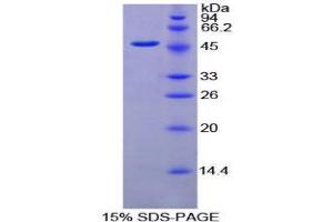 SDS-PAGE (SDS) image for Fibrinogen gamma Chain (FGG) (AA 27-435) protein (His tag) (ABIN1079535) (FGG Protein (AA 27-435) (His tag))