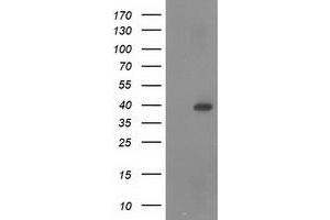 HEK293T cells were transfected with the pCMV6-ENTRY control (Left lane) or pCMV6-ENTRY RASSF1 (Right lane) cDNA for 48 hrs and lysed. (RASSF1 antibody)