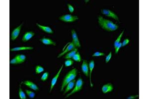 Immunofluorescent analysis of Hela cells using ABIN7152122 at dilution of 1:100 and Alexa Fluor 488-congugated AffiniPure Goat Anti-Rabbit IgG(H+L) (EEF1E1 antibody  (AA 2-174))