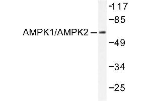 Image no. 1 for anti-Protein Kinase, AMP-Activated, alpha 1 Catalytic Subunit (PRKAA1) antibody (ABIN265306) (PRKAA1 antibody)