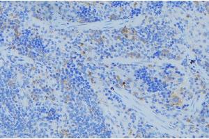 ABIN6273685 at 1/100 staining Human lymph node tissue by IHC-P. (Keratin 77 antibody  (Internal Region))