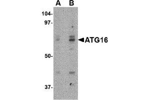 Western Blotting (WB) image for anti-ATG16 Autophagy Related 16-Like 1 (ATG16L1) (Middle Region) antibody (ABIN1030869) (ATG16L1 antibody  (Middle Region))