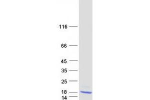 Validation with Western Blot (CST6 Protein (Myc-DYKDDDDK Tag))