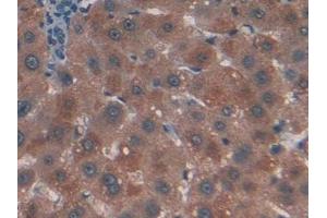 DAB staining on IHC-P; Samples: Human Liver Tissue (CTNNBIP1 antibody  (AA 1-81))