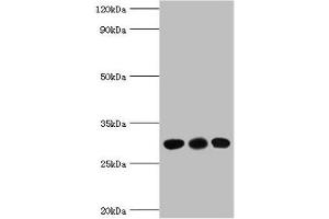Western blot All lanes: CA1 antibody at 6 μg/mL Lane 1: Jurkat whole cell lysate Lane 2: K562 whole cell lysate Lane 3: Mouse spleen tissue Secondary Goat polyclonal to rabbit IgG at 1/10000 dilution Predicted band size: 29 kDa Observed band size: 29 kDa