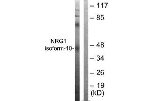 Western Blotting (WB) image for anti-Neuregulin 1 (NRG1) (Isoform 10), (N-Term) antibody (ABIN6299311) (Neuregulin 1 antibody  (Isoform 10, N-Term))
