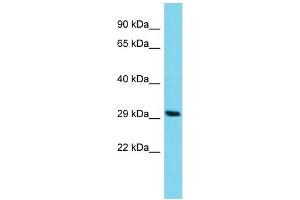 Host: Rabbit Target Name: C14orf105 Sample Type: HCT15 Whole Cell lysates Antibody Dilution: 1. (C14ORF105 antibody  (C-Term))