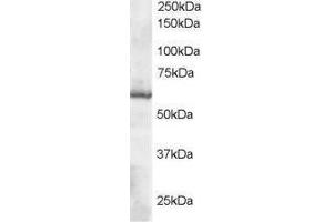 Image no. 1 for anti-Thioredoxin Reductase 1 (TXNRD1) (C-Term) antibody (ABIN374236) (TXNRD1 antibody  (C-Term))