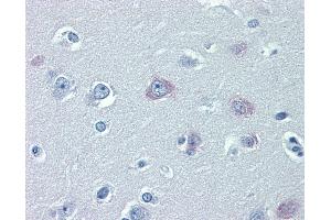 Anti-TRPM2 antibody IHC of human brain, cortex. (TRPM2 antibody  (AA 431-480))