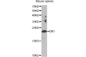 Western blot analysis of extracts of mouse spleen, using DR1 antibody. (DR1 antibody)