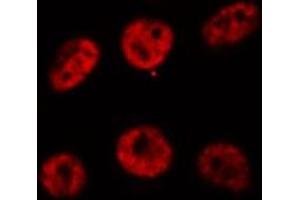 ABIN6269310 staining HeLa cells by IF/ICC. (RUNX1 antibody  (Internal Region))