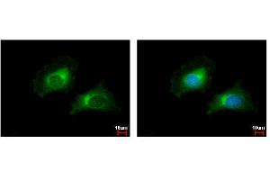 ICC/IF Image CARD6 antibody [N1N2], N-term detects CARD6 protein at cytoplasm by immunofluorescent analysis. (CARD6 antibody  (N-Term))