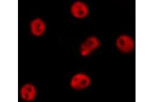 ABIN6277531 staining  RAW264. (GTF2A1 antibody  (Internal Region))